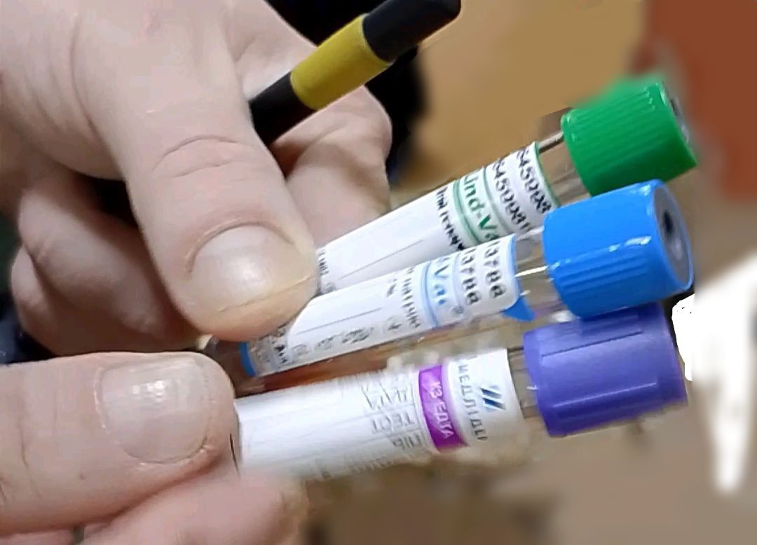 Медикам на Донеччині терміново потрібні витратні матеріали для лабораторій